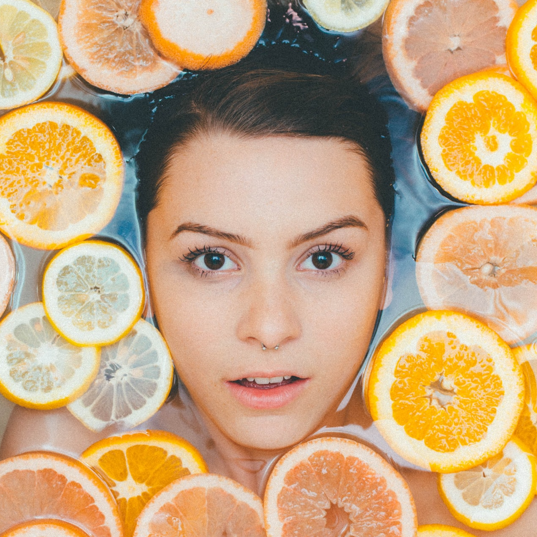 What are the Best Foods for your Skin?